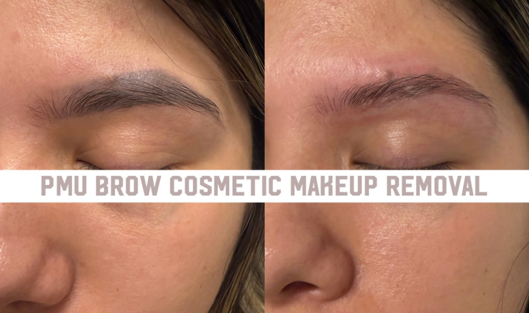 powder brow removal Sarasota